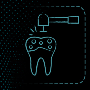 تنضيف جير الأسنان