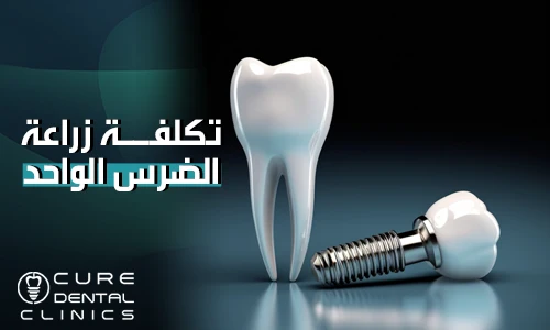 افضل جودة و تكلفة زراعة الضرس الواحد 2024