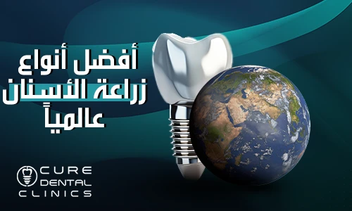 افضل انواع زراعة الأسنان تدوم مدي الحياه