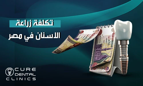 أقل تكلفة زراعة الاسنان في مصر 2024