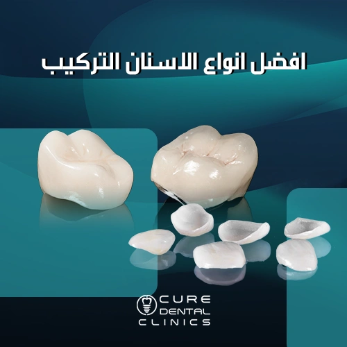 افضل انواع الاسنان التركيب لأبتسامة هوليوود 2024