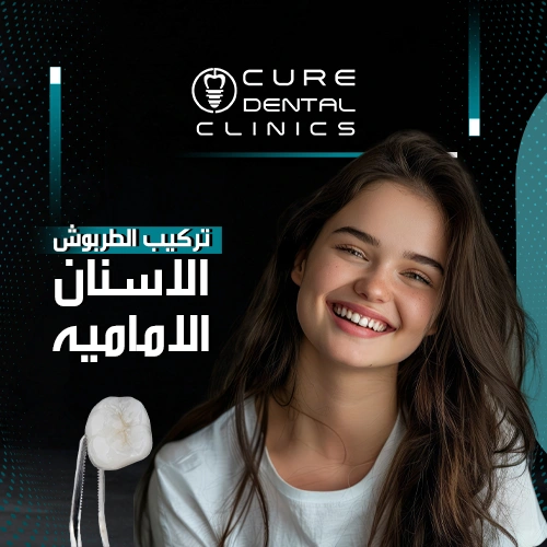 أستمتع بأفضل جوده تركيب طربوش الاسنان الامامية