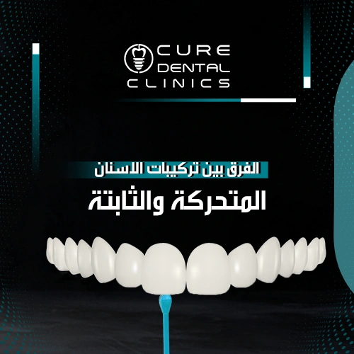 5 أسباب مشاكل تركيبات الاسنان الثابتة التي تواجهك