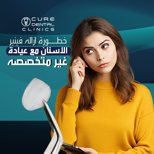 خطورة ازاله فينير الاسنان مع عيادة غير متخصصة