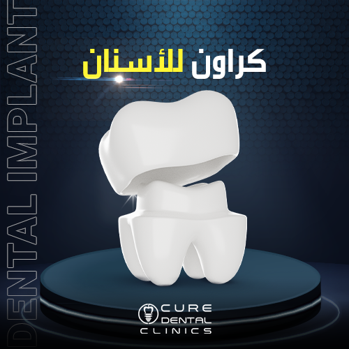 أفضل أنواع الكراون للاسنان 2025