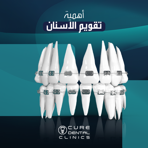 اهمية تقويم الاسنان و متي تحتاجه