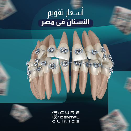 أحجز موعدك مع افضل دكاترة تقويم الاسنان بالنتائج