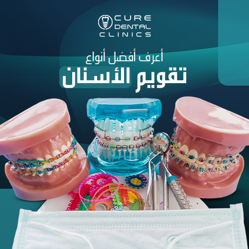 أفضل انواع تقويم الاسنان بدون ألم