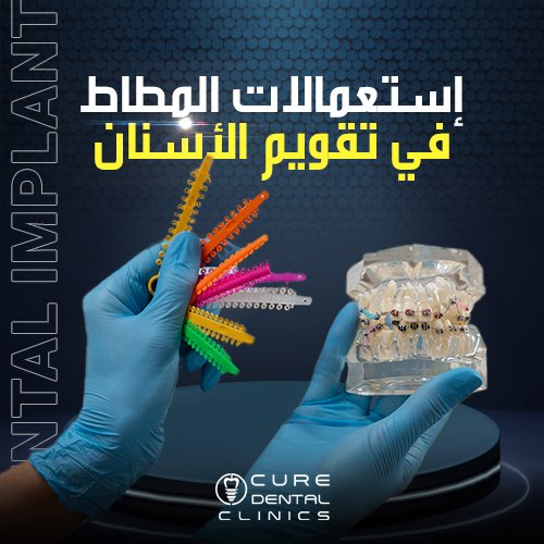 بدائل تقويم الاسنان و استخدامات مطاط الاسنان