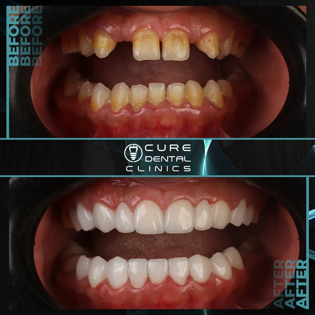 تجميل و زراعه الاسنان