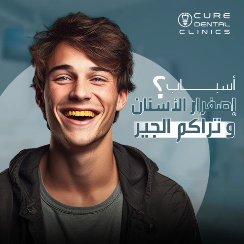 أسباب اصفرار الأسنان و تراكم الجير