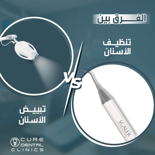 الفرق بين تنظيف وتبييض الاسنان