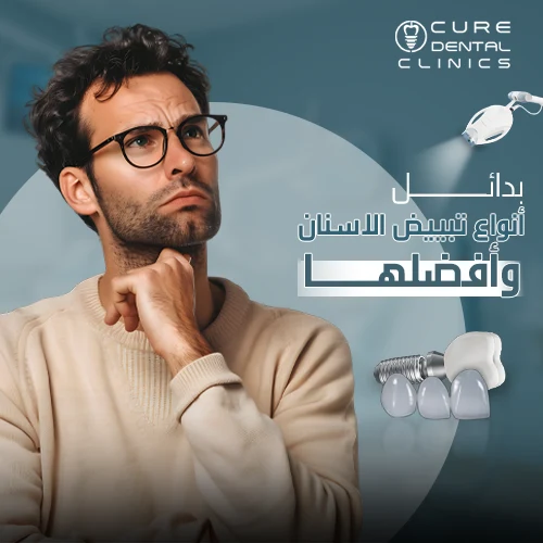 بدائل تبييض الاسنان الأفضل و نتائجها المميزه