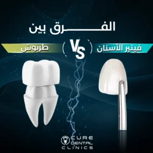 الفرق بين طربوش و فينير الأسنان بدون برد
