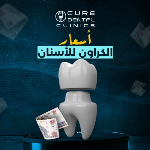 اسعار الكراون للاسنان في مصر
