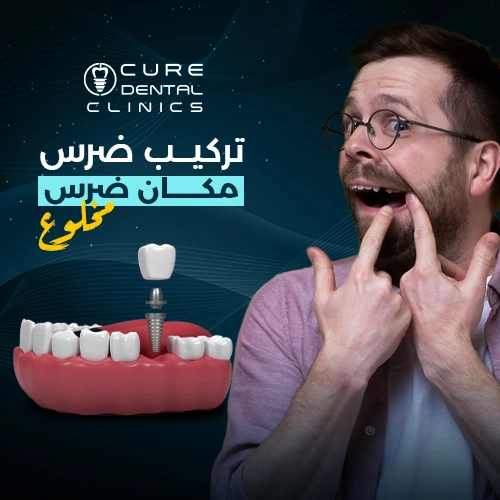 دكتور أخصائي تركيب ضرس مكان المخلوع