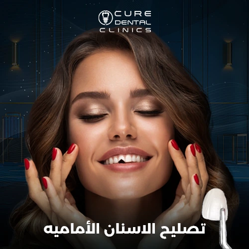 تجميل وتصليح الاسنان الأماميه بالفينيرز