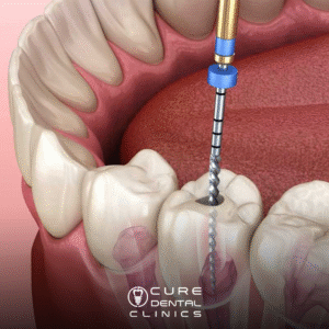 جذور الاسنان